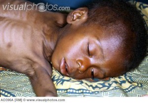 Child dying of AIDS, Nigeria, Africa.