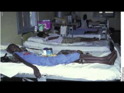 Lassa fever patients