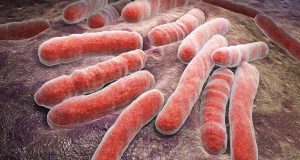 WHO Rates Nigeria Second Highest In Tuberculosis Case In Africa