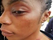 How I Was Beaten, Stripped Naked At PDP Primary – Benue Assembly Female Aspirant