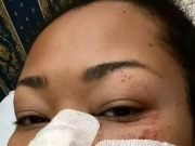 My Spirit Unbroken, Natasha Akpoti Vows As She Rises From Unconsciousness